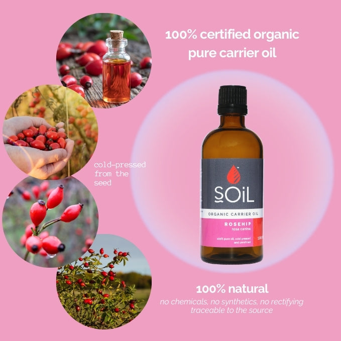 Organic Rosehip Oil (Rosa canina) — 30ml