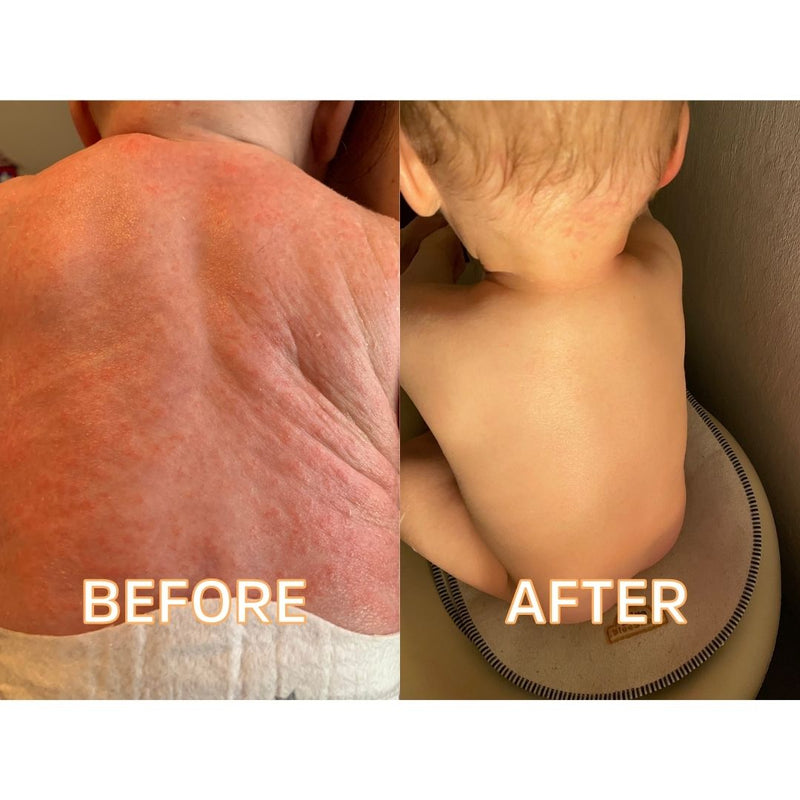 Baby Butta 8oz – Soothing Skin Butter for Littles by FATCO skincare