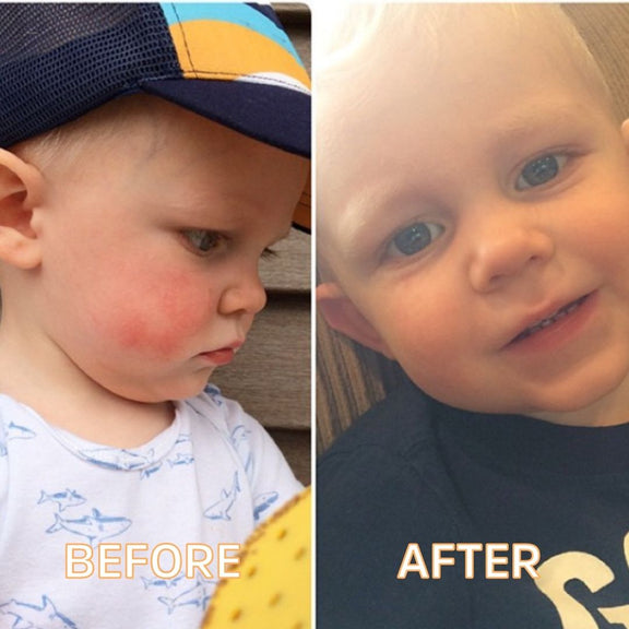Baby Butta 8oz – Soothing Skin Butter for Littles by FATCO skincare