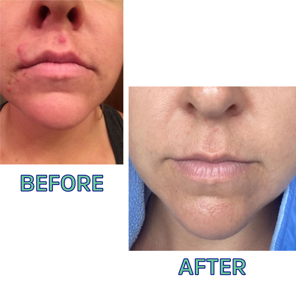 Cleansing Oil for Normal/Combo Skin – 2oz Glow Balance by FATCO skincare