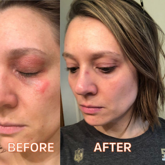 Myrrhaculous Face Cream 1 Oz by FATCO skincare