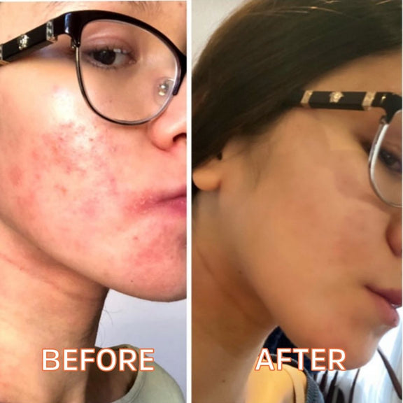 Myrrhaculous Face Cream 1 Oz by FATCO skincare