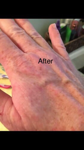 organic Handmade No More Eczema Soap