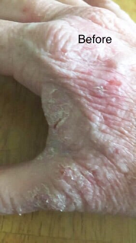 organic Handmade No More Eczema Soap