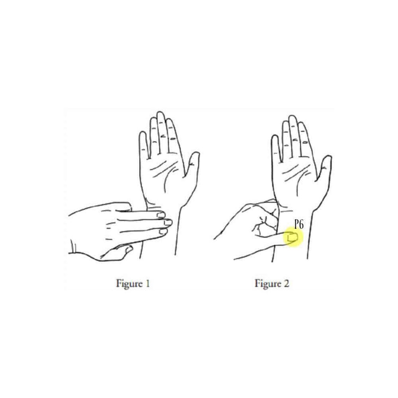 morning sickness acupressure sea bands